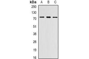 Western blot analysis of PRDM6 expression in Jurkat (A), MCF7 (B), mouse lung (C) whole cell lysates. (PRDM6 Antikörper)