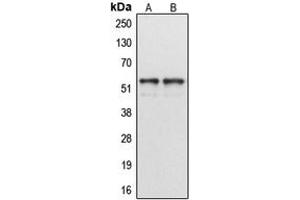Western blot analysis of Cytochrome P450 1A1/2 expression in MCF7 (A), HeLa (B) whole cell lysates. (CYP1A1/2 Antikörper  (Center))