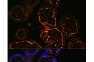 Immunofluorescence analysis of Human placenta cells using LDB3 Polyclonal Antibody at dilution of 1:100. (LIM Domain Binding 3 Protein Antikörper)