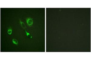 Immunofluorescence staining of methanol-fixed HeLa cells using EPHA2/3/4 (Phospho-Tyr588/596) Antibody.