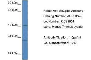 Western Blotting (WB) image for anti-SH3-Domain GRB2-Like Endophilin B1 (SH3GLB1) (N-Term) antibody (ABIN2787862) (SH3GLB1 Antikörper  (N-Term))