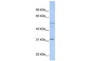 ZFYVE19 antibody used at 0. (ZFYVE19 Antikörper  (C-Term))