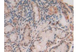 IHC-P analysis of Human Stomach Tissue, with DAB staining. (S100A11 Antikörper  (AA 1-105))