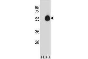 Western blot analysis of CD33 antibody and 293 cell lysate (2 ug/lane) either nontransfected (Lane 1) or transiently transfected (2) with the CD33 gene. (CD33 Antikörper  (AA 88-117))