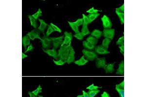 Immunofluorescence analysis of A549 cells using HAGH Polyclonal Antibody (HAGH Antikörper)