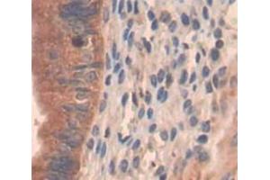 Used in DAB staining on fromalin fixed paraffin- embedded Kidney tissue (PI4KA Antikörper  (AA 1-300))