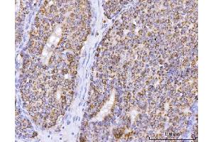 IHC analysis of ATP5F1B using anti-ATP5F1B antibody (ABIN7599866). (Atp5f1b (AA 123-529) Antikörper)