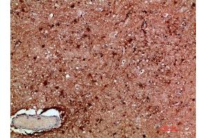 Immunohistochemical analysis of paraffin-embedded human-brain, antibody was diluted at 1:200
