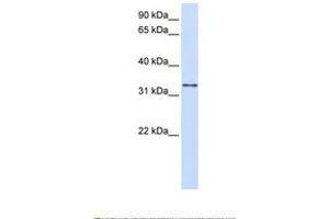 Image no. 1 for anti-Trans-2,3-Enoyl-CoA Reductase (TECR) (AA 218-267) antibody (ABIN6738460) (TECR Antikörper  (AA 218-267))