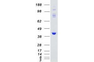 Western Blotting (WB) image for G Protein-Coupled Receptor Kinase 5 (GRK5) protein (Myc-DYKDDDDK Tag) (ABIN2722199)