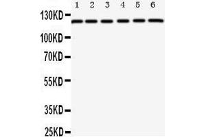 Western Blotting (WB) image for anti-Coxsackie Virus and Adenovirus Receptor (CXADR) (AA 313-328), (C-Term) antibody (ABIN3044083) (Coxsackie Adenovirus Receptor Antikörper  (C-Term))