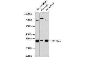 Western blot analysis of extracts of various cell lines, using MT-ND1 antibody (ABIN7268597) at 1:1000 dilution. (MT-ND1 Antikörper)
