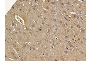 ABIN7093774 and ABIN7097815 at 1/100 staining rat brain tissue by IHC-P.