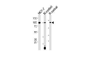 Western blot analysis in MCF-7 cell line and mouse eyeball,rat eyeball tissue lysates (35ug/lane). (COL9A1 Antikörper  (AA 428-456))