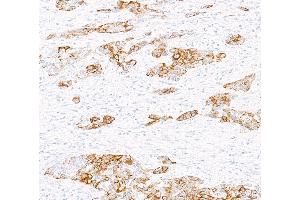 Immunohistochemistry (IHC) image for anti-Keratin 6 (KRT6) (C-Term) antibody (ABIN7795792)