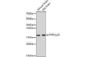 Western blot analysis of extracts of various cell lines, using TPPP/p25 Rabbit mAb (ABIN7271031) at 1:5000 dilution. (Tppp Antikörper)