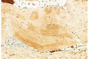 ABIN6259723 and ABIN6279112 at 1/100 staining Mouse skin tissue by IHC-P. (ASIC1 Antikörper  (C-Term))