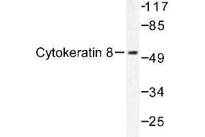 Image no. 1 for anti-Keratin 8 (KRT8) antibody (ABIN272030) (KRT8 Antikörper)