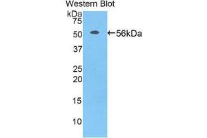 Western Blotting (WB) image for anti-Acidic (Leucine-Rich) Nuclear phosphoprotein 32 Family, Member A (ANP32A) (AA 2-247) antibody (ABIN1858013)
