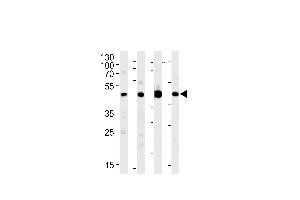 MEK1 Antibody (M1) (ABIN1882177 and ABIN2842020) western blot analysis in Jurkat,PC-12,rat C6 cell line and mouse brain lysates (35 μg/lane). (MEK1 Antikörper  (N-Term))