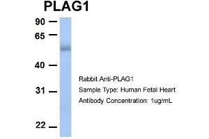 Host:  Rabbit  Target Name:  PLAG1  Sample Type:  Human Fetal Heart  Antibody Dilution:  1. (PLAG1 Antikörper  (N-Term))