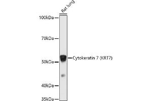 Western Blotting (WB) image for anti-Keratin 7 (KRT7) (AA 1-94) antibody (ABIN6143037)