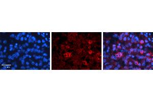 Immunohistochemistry (IHC) image for anti-Prostaglandin-Endoperoxide Synthase 1 (Prostaglandin G/H Synthase and Cyclooxygenase) (PTGS1) (Middle Region) antibody (ABIN2777019) (PTGS1 Antikörper  (Middle Region))