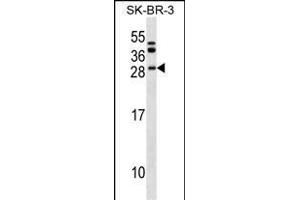 BCL7C Antibody (N-term) (ABIN1539556 and ABIN2849559) western blot analysis in SK-BR-3 cell line lysates (35 μg/lane).