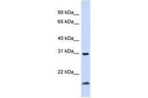 Image no. 1 for anti-Tumor Necrosis Factor (Ligand) Superfamily, Member 14 (TNFSF14) (C-Term) antibody (ABIN6744345) (TNFSF14 Antikörper  (C-Term))