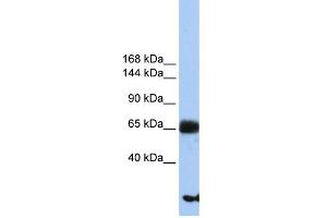 WB Suggested Anti-PIGO Antibody Titration:  0. (PIGO Antikörper  (N-Term))