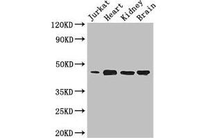 Western Blot Positive WB detected in: Jurkat whole cell lysate, Mouse heart tissue, Mouse kidney tissue, Mouse brain tissue All lanes: DOK2 antibody at 3. (DOK2 Antikörper  (AA 123-412))