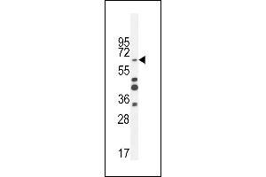 ZNF98 Antibody (C-term) (ABIN654480 and ABIN2844215) western blot analysis in MDA-M cell line lysates (35 μg/lane).