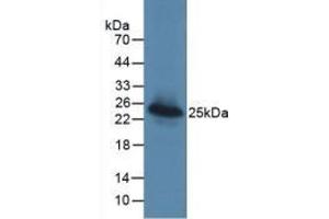 Detection of Recombinant LGALS3BP, Human using Monoclonal Antibody to Lectin Galactoside Binding, Soluble 3 Binding Protein (LGALS3BP) (LGALS3BP Antikörper  (AA 24-221))