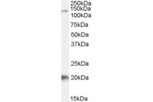 Image no. 1 for anti-HIV-1 Tat Specific Factor 1 (HTATSF1) (Internal Region), (N-Term) antibody (ABIN375208) (HTATSF1 Antikörper  (Internal Region, N-Term))