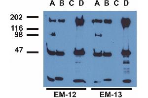 Immunoprecipitation ofEGFR from EGF-treated A431 cells by monoclonal antibodies EM-12 (A), (B), a commercial anti-EGFR polyclonal antibody (C)and anti-EGFR monoclonal mAb108 (D). (EGFR Antikörper  (Tyr1173))
