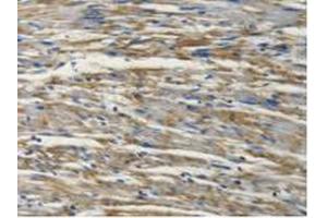 Figure. (PSMC4 Antikörper  (AA 1-418))