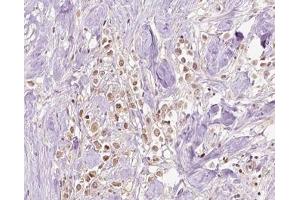 Immunohistochemistry (IHC) image for anti-Vacuolar Protein Sorting 72 Homolog (S. Cerevisiae) (VPS72) (Internal Region) antibody (ABIN6266000)