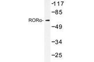 Western blot analysis of RORα antibody in extracts from HeLa cells. (RORA Antikörper)