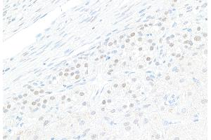 Immunohistochemistry (IHC) image for anti-GATA Binding Protein 4 (GATA4) (AA 392-442) antibody (ABIN7453878)