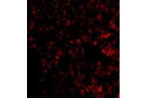 Immunofluorescence of Blimp-1 in mouse lung tissue with AP30154PU-N Blimp-1 antibody at 20 μg/ml. (PRDM1 Antikörper  (C-Term))