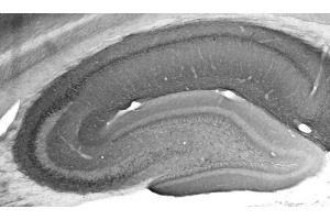 Adult rat hippocampus immunohistochemistry.