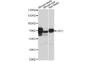 Western blot analysis of extracts of various cell lines, using CRY1 antibody (ABIN6291957) at 1:1000 dilution. (CRY1 Antikörper)