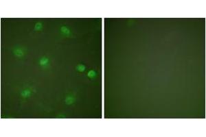 Immunofluorescence analysis of HeLa cells, using MEF2A (Ab-408) Antibody. (MEF2A Antikörper  (AA 374-423))