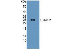 Detection of Recombinant PSMD5, Human using Polyclonal Antibody to Proteasome 26S Subunit, Non ATPase 5 (PSMD5) (Proteasome 26S Subunit, Non ATPase 5 (AA 143-341) Antikörper)