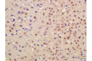 Formalin-fixed and paraffin embedded mouse brain labeled with Rabbit Anti-HRG beta 1 Polyclonal Antibody, Unconjugated  at 1:200 followed by conjugation to the secondary antibody and DAB staining (Hrg beta 1 (AA 65-150) Antikörper)
