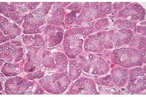 Image no. 2 for anti-Phospholipid Transfer Protein (PLTP) (C-Term) antibody (ABIN6749777) (PLTP Antikörper  (C-Term))
