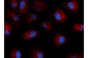 Immunofluorescence (IF) image for anti-Tetraspanin 26 (TSPAN26) (AA 112-241) antibody (APC) (ABIN5566694) (CD37 Antikörper  (AA 112-241) (APC))