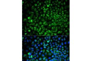 Immunofluorescence analysis of U2OS cells using COMT Polyclonal Antibody (COMT Antikörper)