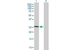 Western Blot analysis of CHCHD3 expression in transfected 293T cell line by CHCHD3 MaxPab polyclonal antibody. (CHCHD3 Antikörper  (AA 1-227))