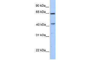 CCDC60 antibody used at 1 ug/ml to detect target protein. (CCDC60 Antikörper  (C-Term))